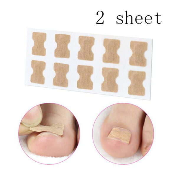 Glue-free orthopaedic nail fixation device - Image 7
