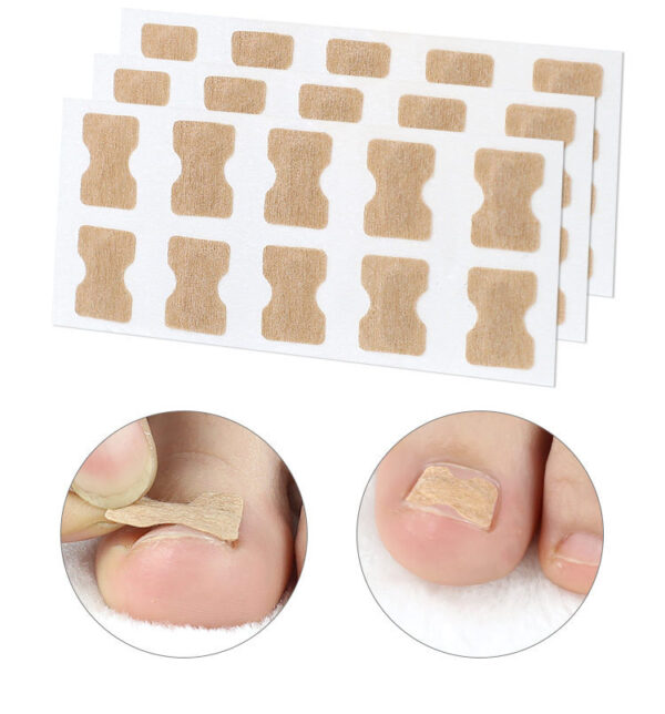 Glue-free orthopaedic nail fixation device - Image 6