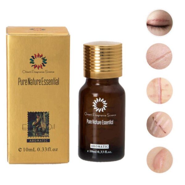 Dredge Meridian Skin Care Natural Pure Removal Acne Stretch Marks Scar Removal Essence oil - Image 2