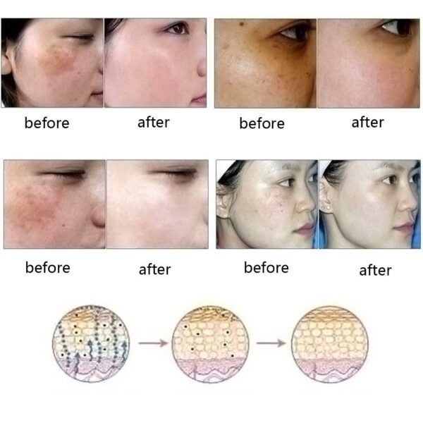 Dredge Meridian Skin Care Natural Pure Removal Acne Stretch Marks Scar Removal Essence oil - Image 3