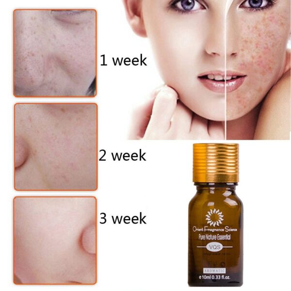 Dredge Meridian Skin Care Natural Pure Removal Acne Stretch Marks Scar Removal Essence oil - Image 6