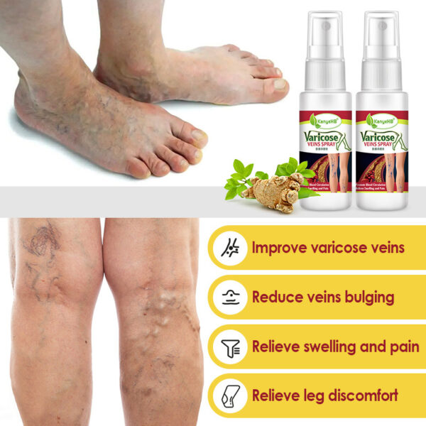 Vein Spray Earthworm Leg Vascular Fluid - Image 4