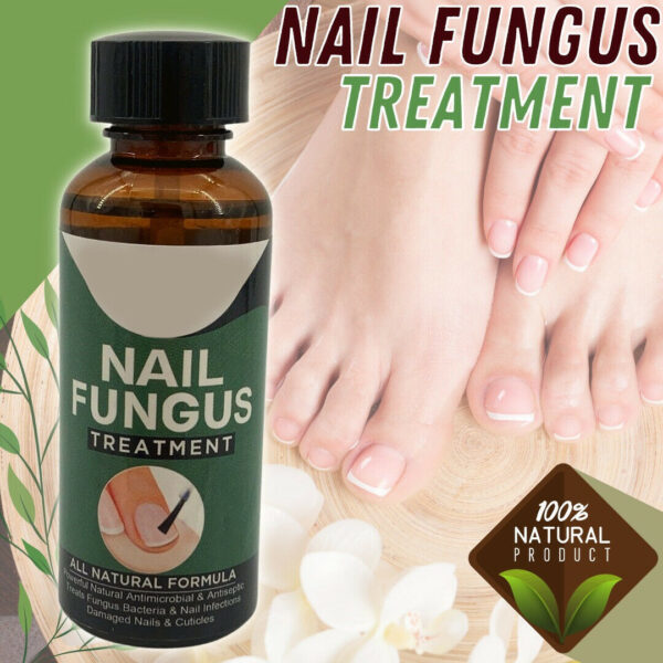 Anti Fungal Nail Treatment Nail Finger Toe Fungus Onychomycosis Remover - Image 7