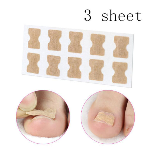 Glue-free orthopaedic nail fixation device - Image 8