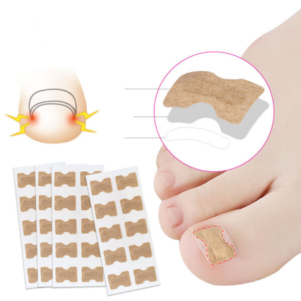 Glue-free orthopaedic nail fixation device - Image 5