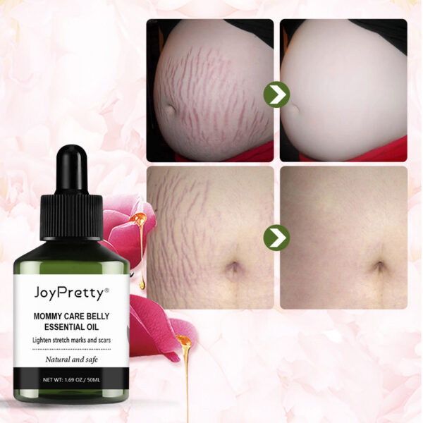 Reduce Postpartum Obesity And Stretch Marks Repair Essential Oil - Image 2